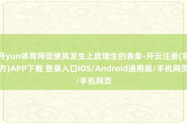 开yun体育网促使其发生上皮增生的表象-开云注册(官方)APP下载 登录入口IOS/Android通用版/手机网页
